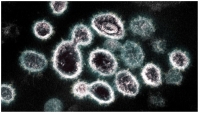 Imajen mikroskópiku elektrón hatudu coronavírus ne’ebé kauza moras Covid-19.